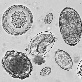 tapeworm under a microscope